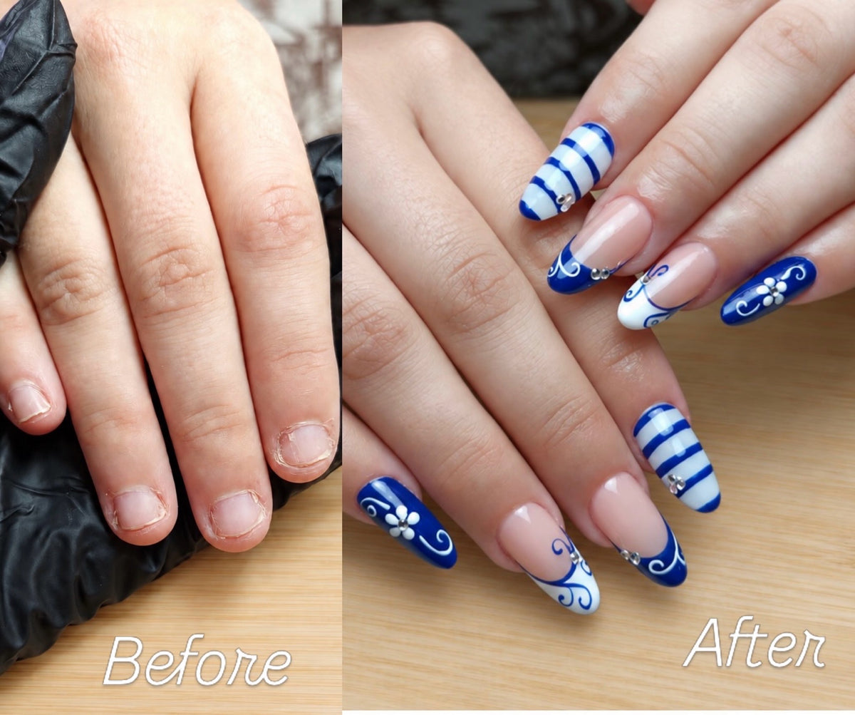 Before After